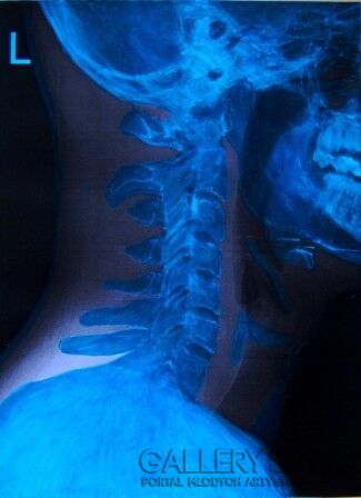 First26353 Last26353-Blue Skull-Technika mieszana