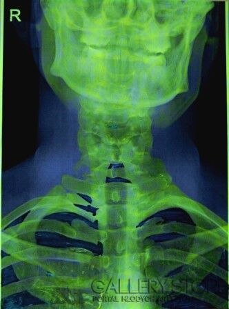 First26353 Last26353-Green Skull-Technika mieszana