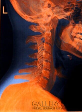 First26353 Last26353-Orange Skull-Technika mieszana
